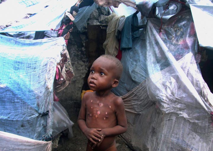 golod-somali-2011-14.jpg
